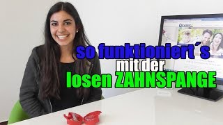 so funktioniert´s mit der losen ZAHNSPANGE  Orthodentix [upl. by Dick]