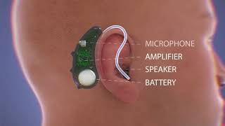 How Do Hearing Aids Work Video [upl. by Tarsus279]