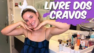 COMO ACABAR COM OS CRAVOS  SKINCARE PARA CRAVOS [upl. by Phipps532]