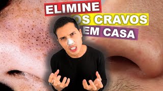 COMO REMOVER CRAVOS DO NARIZ EM 6 MINUTOS EM CASA [upl. by Eicaj]