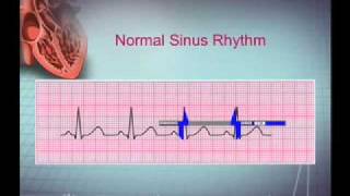 Intro EKG Interpretation Part 1 [upl. by Sayer]