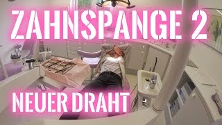 Zahnspange Teil 2  Neuer Zahnbogen  2016  Emma Sophie [upl. by Awad]