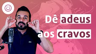 Como Remover Cravos do Rosto de Forma Natural  Dr Rafael Freitas [upl. by Grevera]